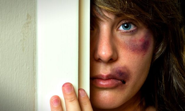 A brutálisan bántalmazott Orosz Bernadettnek becsületsértés miatt kell bíróság elé állnia az őt megverő férfival szemben