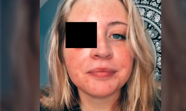 Letépte a vendég szemhéját a kozmetikus csivava kutyája, kórházba vitték a nőt