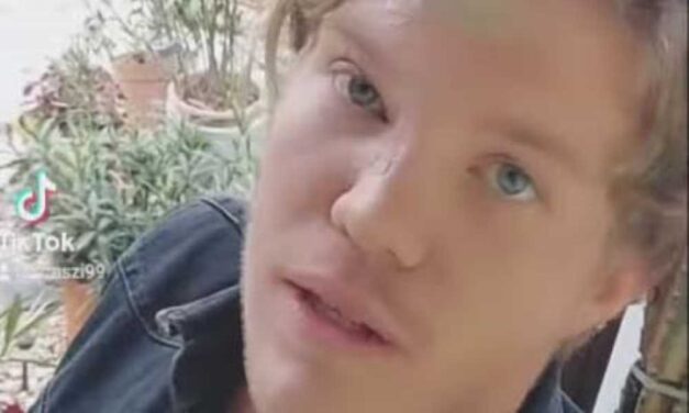 „Még szoknom kell az új arcomat, mivel minden heg a balesetemre emlékeztet” – megszólalt a Sztárban sztár énekese, akinek centiken múlt az élete