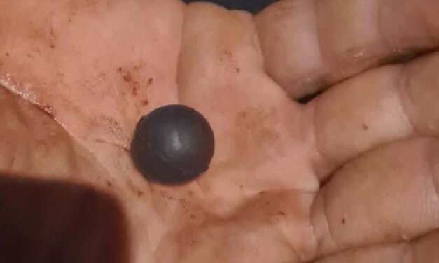 „Megdöglesz, meghal az egész családod!” – kézen lőtte vejét egy 58 éves férfi Kiskunlacházán, mert lánya érdekeit védte