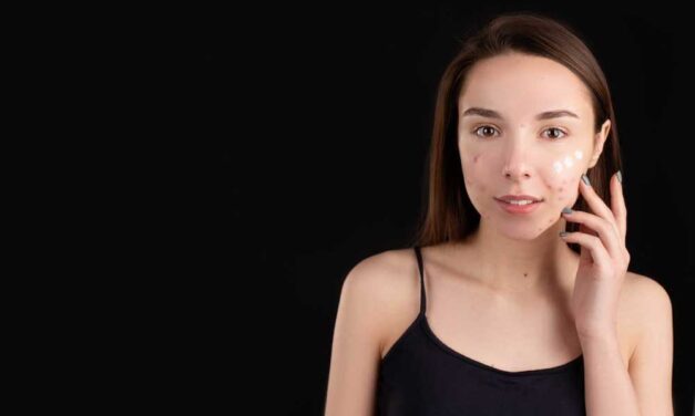 Hogyan javítható a pattanásos, aknés bőr? Tudj meg többet a fekete szappanról!