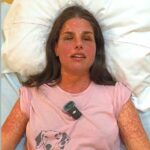 A világ egyik legritkább betegségét diagnosztizálták Agárdi Szilvinél, kínzó fájdalmak gyötrik a látássérült énekesnőt – videó a cikkben